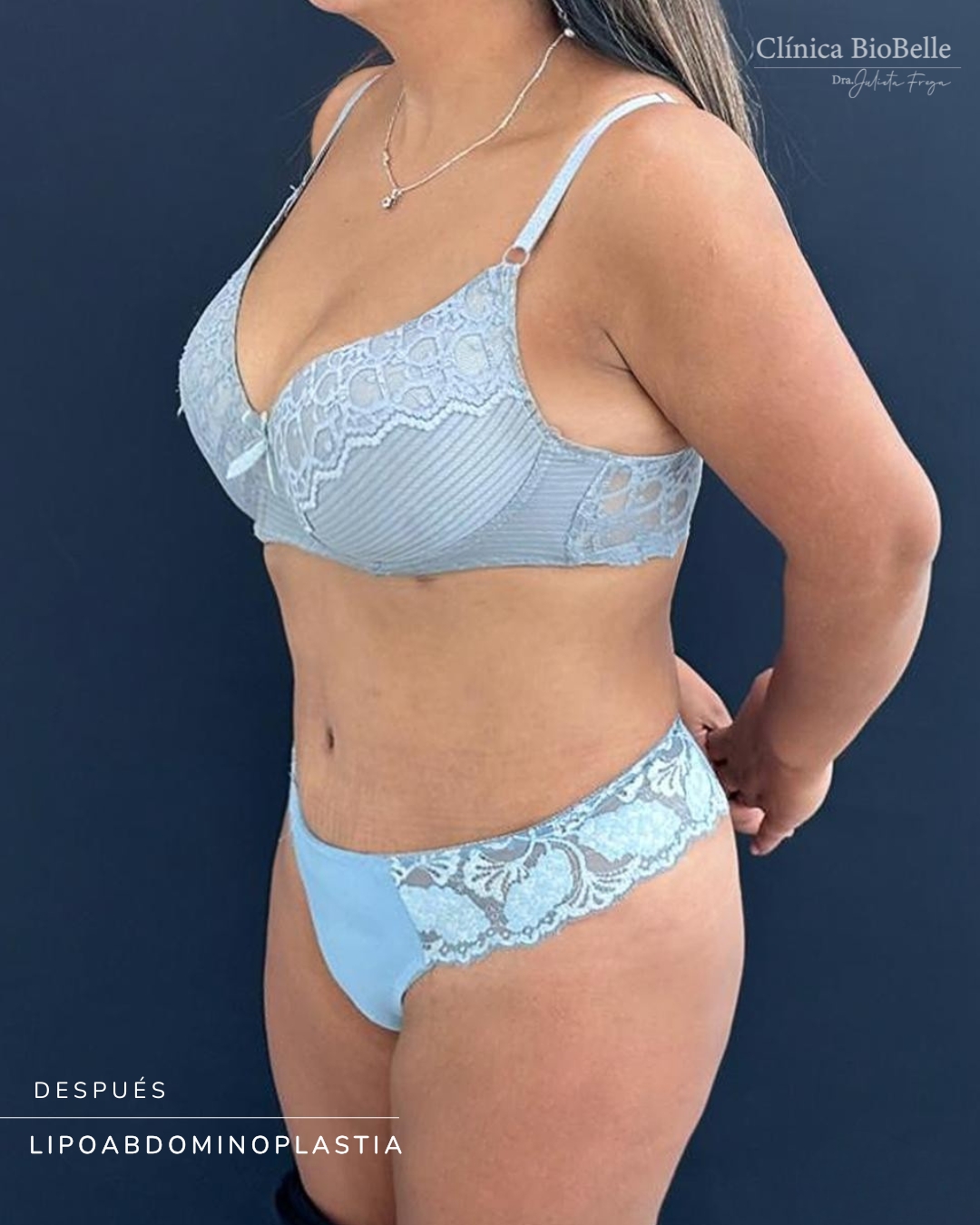 Compartimos un caso de antes y después de una lipoabdominoplastia.
Cada procedimiento requiere evaluación clínica, indicación quirúrgica y planificación individualizada de acuerdo con las necesidades de cada paciente.
Desliza para ver el resultado.
#Lipoabdominoplastia #AntesYDespues #CirugiaCorporal #CirugiaPlasticaChile ClinicaBiobell