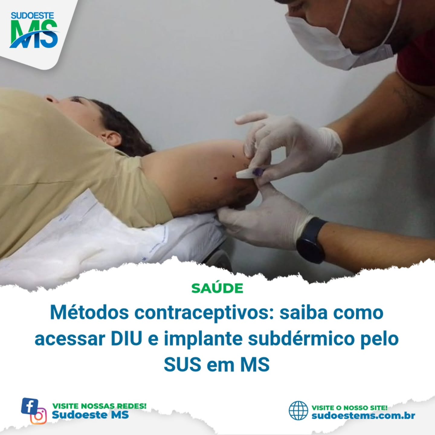Em muitos municípios, a inserção já ocorre na própria UBS, desde que a unidade disponha de profissionais capacitados e estrutura adequada.
Em outros casos, a Secretaria Municipal de Saúde organiza unidades de referência para a realização do procedimento.